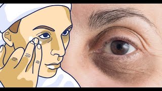 Deshidratación los ¿La causa círculos debajo ojos? de