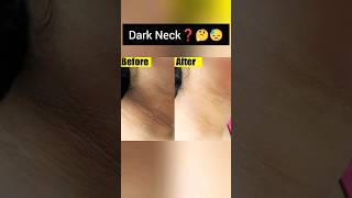 ?Neck Whitening at home/100%lighten dark neckshortsyoutubeshortsdarkneck