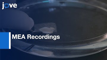 MEA Recordings for Epileptic Postoperative Cortical Tissue | Protocol Preview