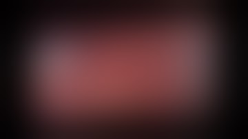 Totally Laparoscopic Right Hepatectomy by Caudate Hepatotomy Technique