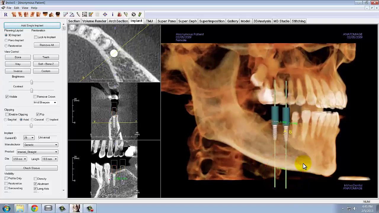 Kavo Library Kavo Dental