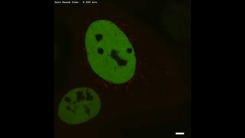 Nucleation and growth of FUS Corelets in live cells