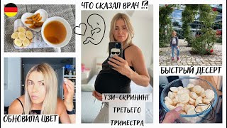 ВЛОГ: УЗИ - скрининг 3 триместра / БЕРЕМЕННОСТЬ 31 НЕДЕЛЯ/ что сказал врач / тянет на сладкое