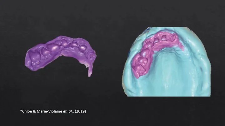 IMMEDIATE COMPLETE DENTURES