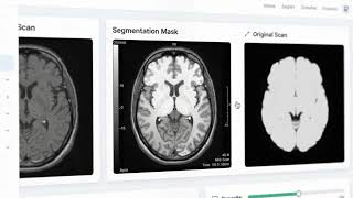 Brain Tumor Detection Classification Segmentation - Beyin Tümörü Tespiti ve İşaretlemesi Yazılımı