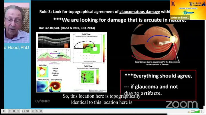 AIOC2021- GP222 - TOPIC - Dr.Donald Hood, PhD -  A...