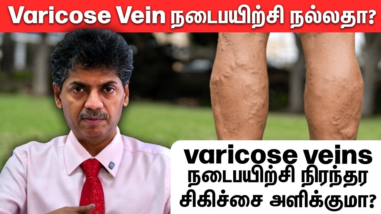 Varicose Vein நடைபயிற்சி நல்லதா? | Does Walking Cure Varicose Veins? | Dr. Bala Kumar