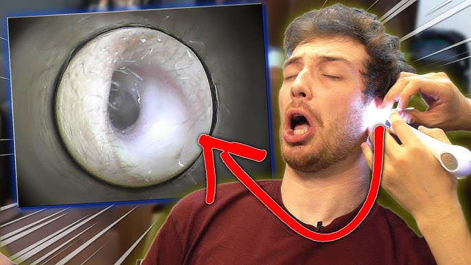 We Used An Earwax Cleaning Camera For The First Time 