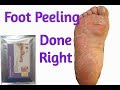 How To Get The Best Results From A Foot Peeling Mask