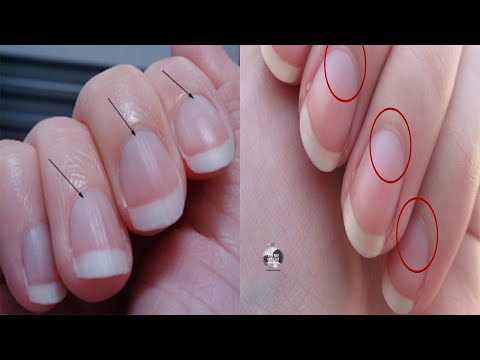 Video: Sa shenja janë rreth gishtit të mikrometrit?