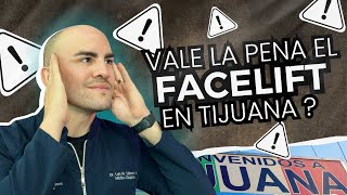 Aesthetic Tourism in Mexico: Is a Facelift in Tijuana Worth It?