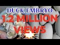 🔴ASMR Balut Duck Embryo EXOTIC DELICACY ep.13