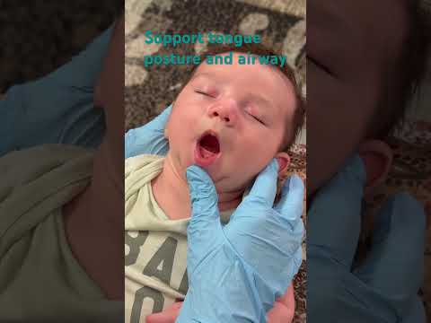 Oral support after a tongue tie release #newborn #baby #infantcare #tonguetie