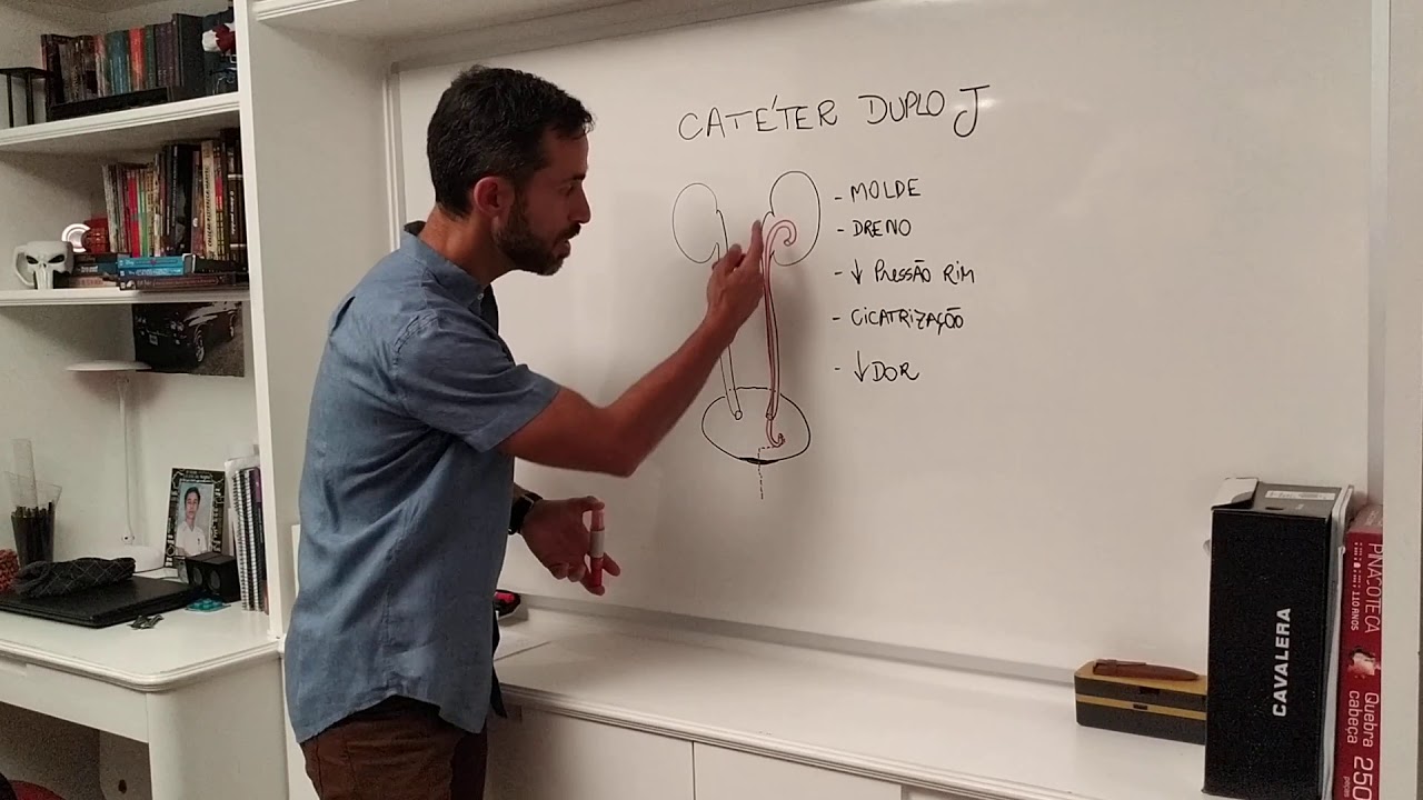 O que é catéter duplo jota? YouTube O que é catéter duplo jota? YouTube