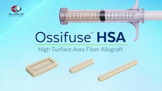 Ossifuse™ HSA Fiber Bone Graft