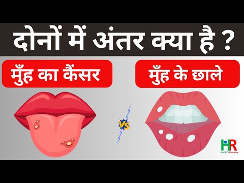 वीडियो: सिर पाल और जिब में क्या अंतर है?