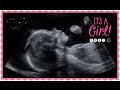 20 weeks Ultrasound GIRL part 1