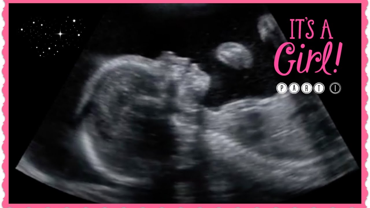 Echographie Semaines Fille Part 1 2d 3d 4d Youtube Echographie Semaines Fille Part 1 2d 3d 4d Youtube