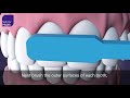 How to Brush Your Teeth Animation MCM