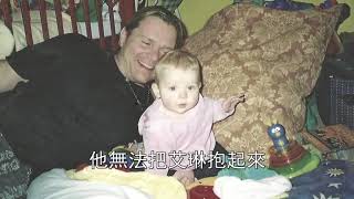 脊椎裂及受傷和心房顫動 - 得醫治 HJ Waller TC corrected