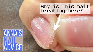 Why is this nail breaking here?!  [Anna's Nail Advice]