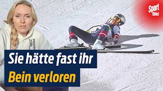 Ski-Star Lindsey Vonn spricht über ihren Unfall und die Operationen