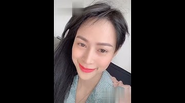 [ Review cấy tóc tự thân #2 ] Review cấy tóc tự thân: Hiểu hơn về cấy tóc tự thân