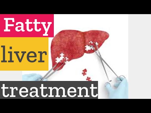 how-to-lose-belly-fat-naturally-with-fatty-liver-treatment?