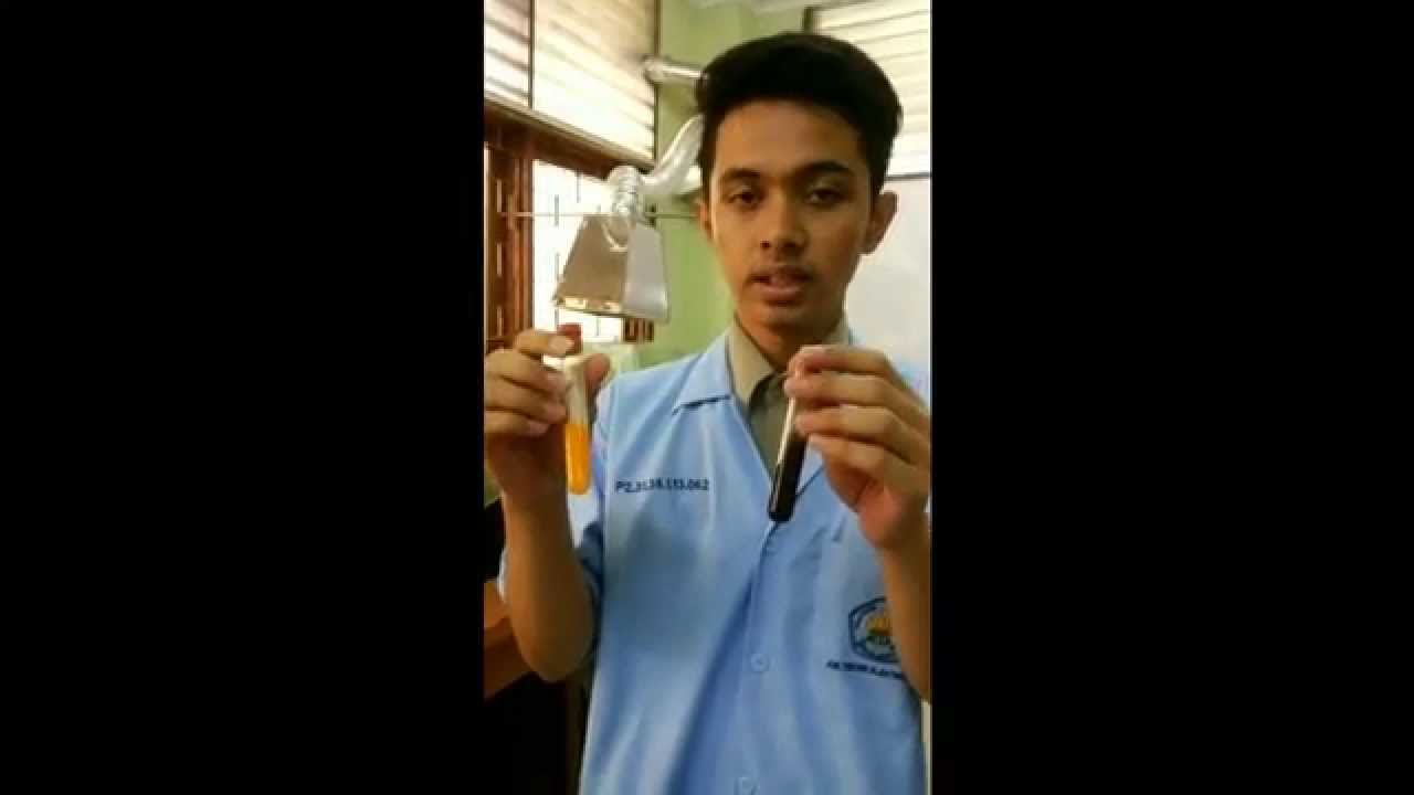Teknik Elektromedik 2013 Kelas D2 Poltekkes Kemenkes Jakarta 2 Centrifuge Youtube