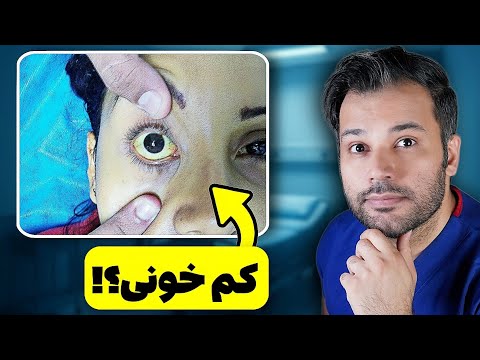 تشخیص فاویسم فقط با 5 علامت مخفی