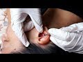 ASMR Removing Blackheads INSIDE EAR CREVICES, Ear Cleaning w. LATEX GLOVES, MY PINKY, Qtips, Massage