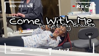 I GOT BRACES!!?!||Destiny Ja’Nay