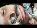 Asmr allzoomed beard picking  scratching  brushing with soft whispers