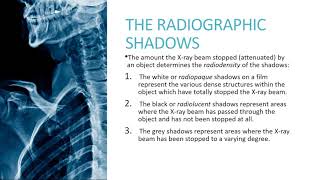 Radiation Physics and Equipment (Lecture 1 and 2)