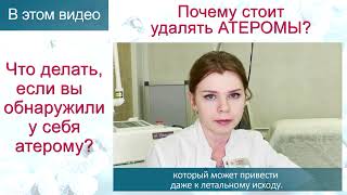 Почему нужно удалять АТЕРОМЫ? Что делать, если вы нашли у себя АТЕРОМУ? Рассказывает врач-хирург.