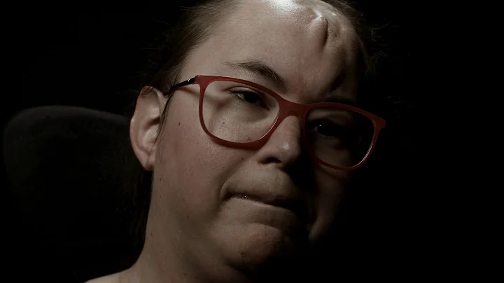 Hope Hoffman, Dilation & Curettage Abortion Survivor