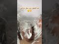 شد الجفون المترهلة من غير جراحة#بلازما-بن#اكسبلور #music #song #cover #newmusic تجميل#أخصائية#👌👌👌😯😯😯