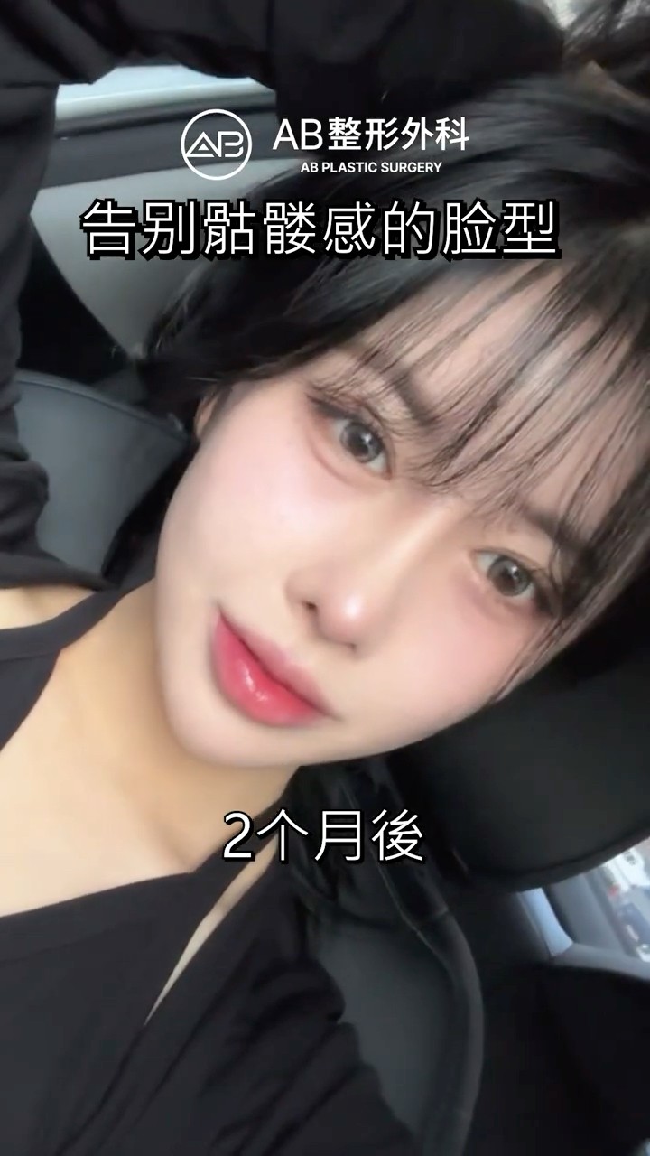 只做隆鼻，整個五官和氣質都不一樣了 #shorts