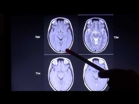 Video: So lesen Sie einen CT-Scan: 8 Schritte (mit Bildern)