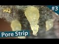 #3 Pore Strip Close up - Blackheads Removal