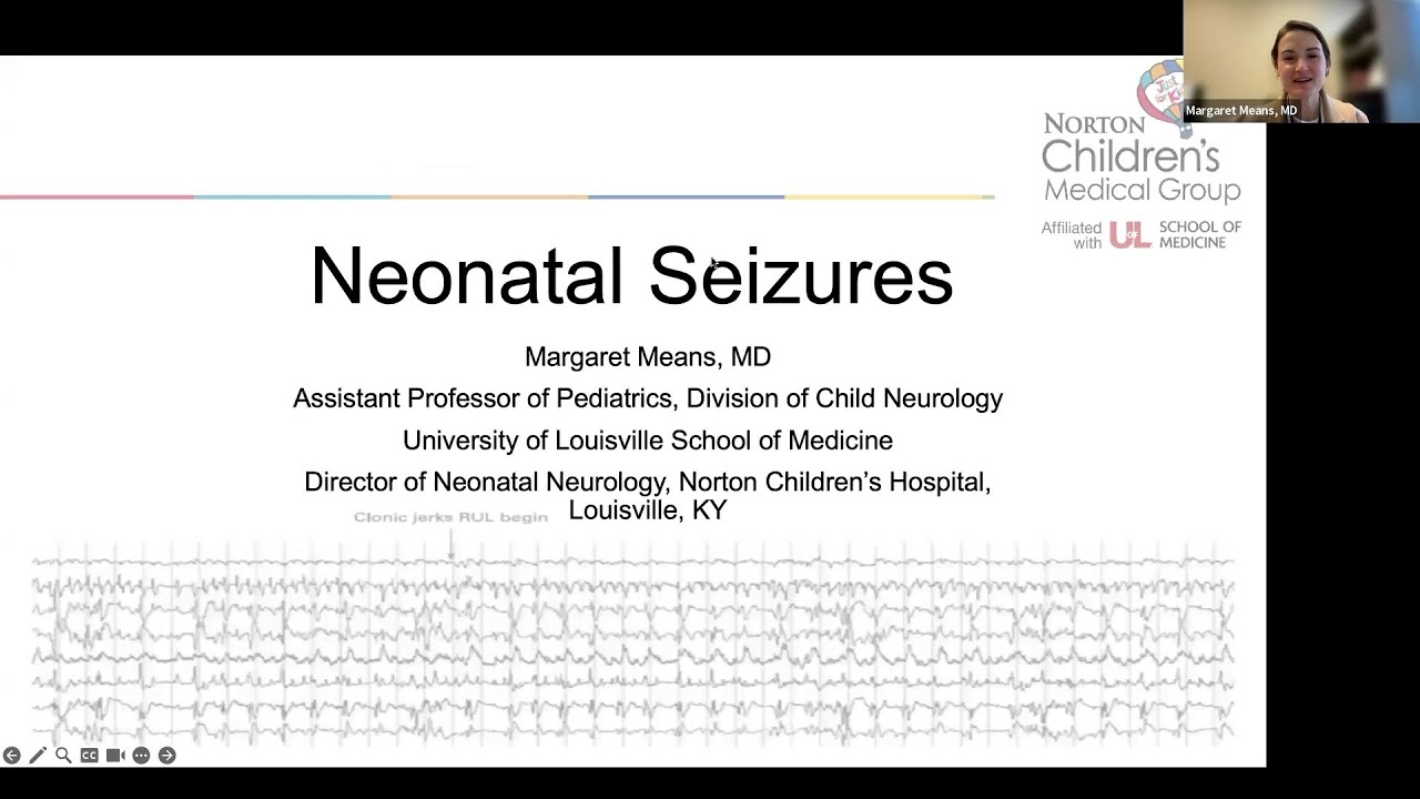 Судороги у новорожденных - Доктор Минс - ONTPD - Круглый стол (онлайн с экспертами)