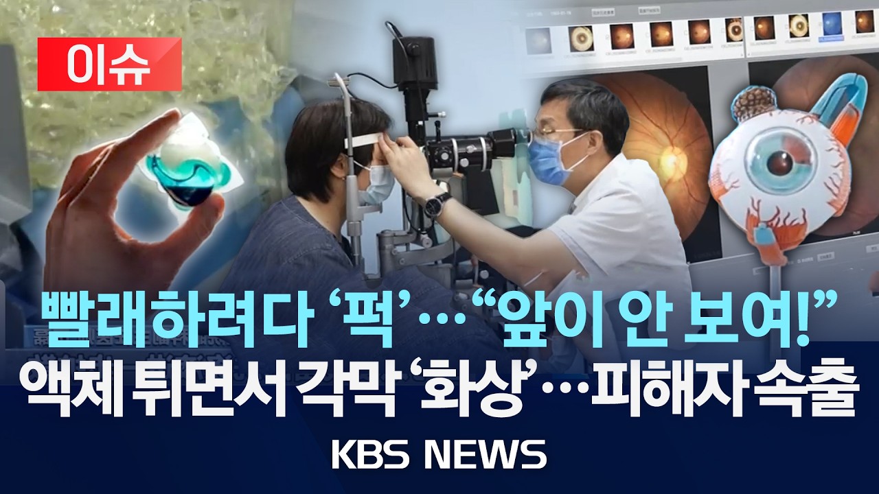 [🔴이슈] 빨래하려다 '퍽'…