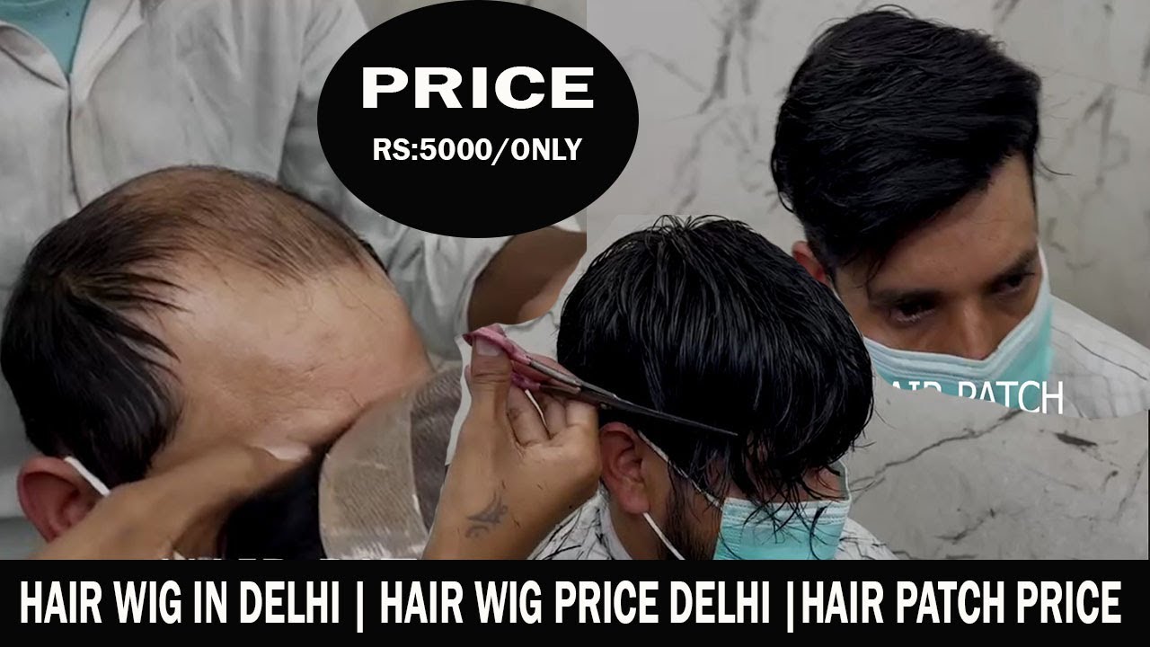 Hair Wig in Rohini Delhi Hair Patch in Rohini Delhi Hair Fixing in