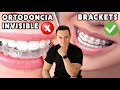La ortodoncia invisible NO ES PARA TODOS | Brackets vs Invisalign