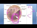 ENT 003 a Tympanic Membrane Anatomy Ear Drum What is Pars Tensa Flaccida Shrapnell annulus umbo Part