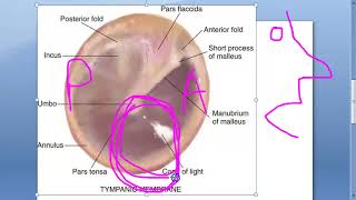 ENT 003 a Tympanic Membrane Anatomy Ear Drum What is Pars Tensa Flaccida Shrapnell annulus umbo Part