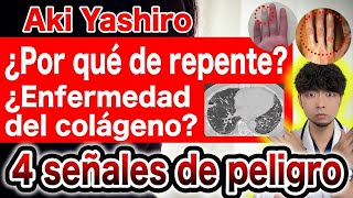 ¿Conoces las señales de enfermedades autoinmunes peligrosas? Te lo explica un médico