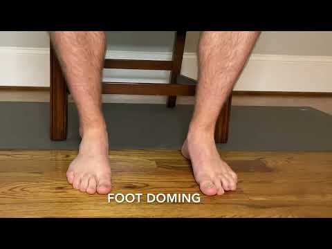 Foot Doming