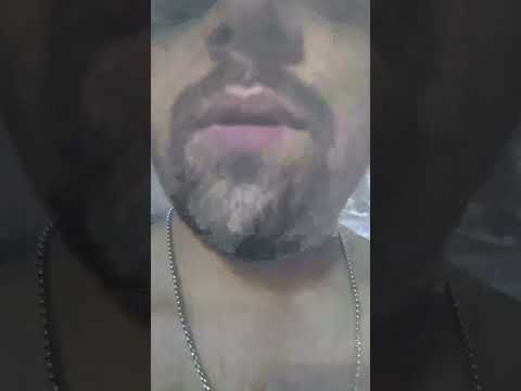 امیدی هست کار کنم بهترش کنم صدارو