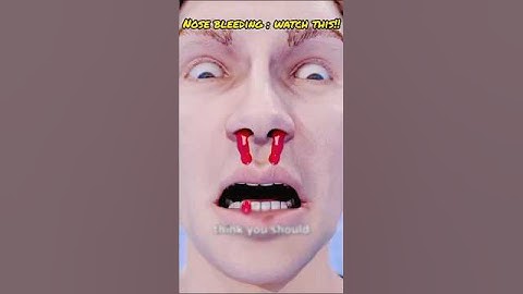 what to do when you have a nosebleed. #vikramsarkar